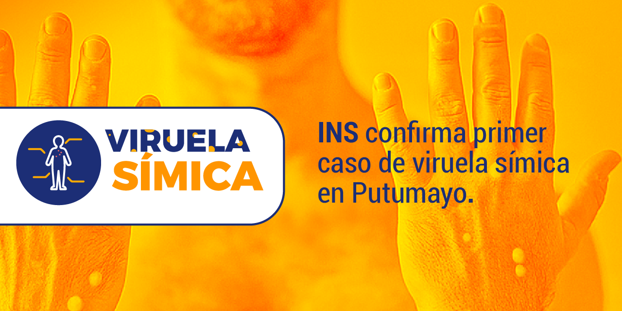 Se confirma primer caso de viruela símica en Putumayo.